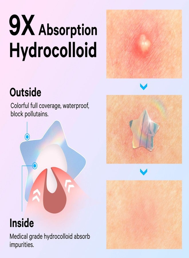 Sosky Hologram Pimple Patches for Face, Hydrocolloid Acne Patches with Salicylic Acid, Cute Star Zit Stickers,Colorful Blemish Covers,36 Count Blue Pink Heart Cloud Flower - Image 3